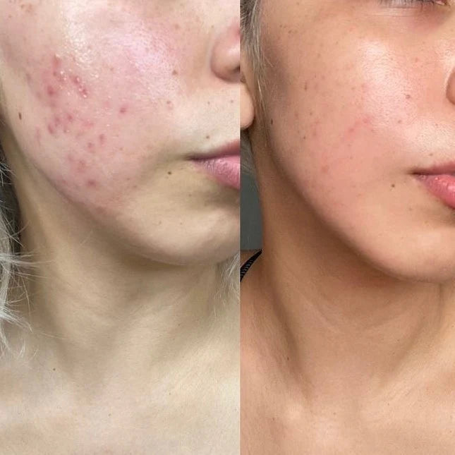 Pirinç Özlü Aydınlatıcı Ampul Serum – Leke, Matlık ve Doku Karşıtı Yoğun Bakım